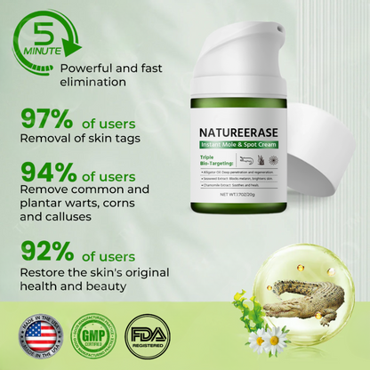 Official Store: NatureErase Instant Mole & Spot Cream