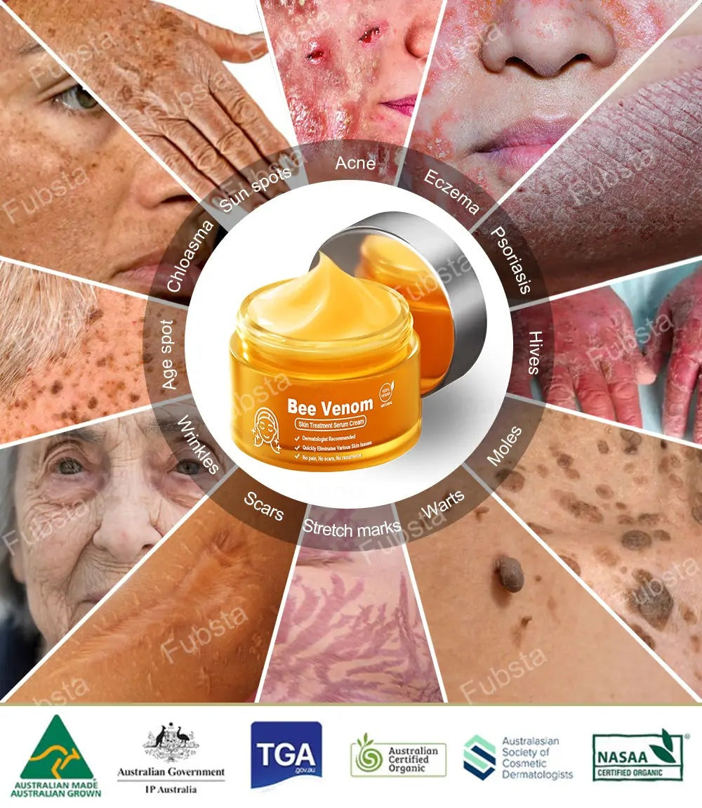🎉𝑩𝒆𝒆 𝑽𝒆𝒏𝒐𝒎 𝑺𝒌𝒊𝒏 𝑻𝒓𝒆𝒂𝒕𝒎𝒆𝒏𝒕 𝑺𝒆𝒓𝒖𝒎 𝑪𝒓𝒆𝒂𝒎👨‍⚕️ (Suitable for all ages & FDA recommends)