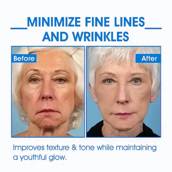 👑𝐅𝐢𝐧𝐚𝐥 𝐃𝐚𝐲 𝐒𝐚𝐯𝐢𝐧𝐠𝐬: 75% 𝐎𝐅𝐅🌐🍋👩‍⚕️ Ultra Firming & Revitalizing Cream: Renew Skin Firmness🔥
