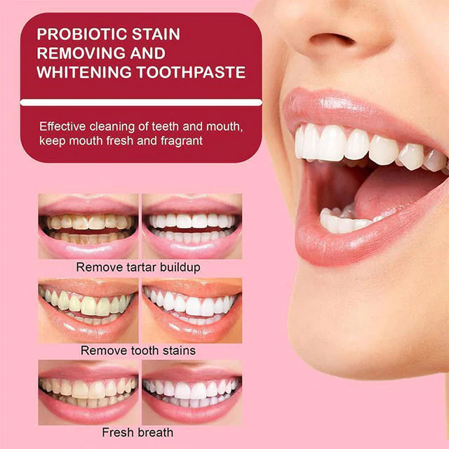 🎁2025 HOT SALE🎁 SP-6 Probiotic Whitening Toothpaste