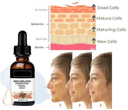 🔥Fast Dark Spot Remover-Melanin Correcting Facial Serum