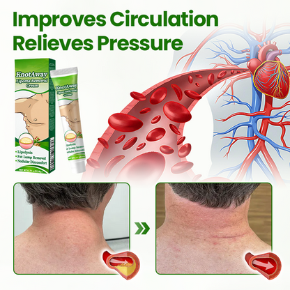 🔥Lipoma Removal Cream