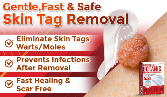 🔥MicroNeedle Botanic Skin Tag Removal Patch 🇺🇸 Made in the USA⏰