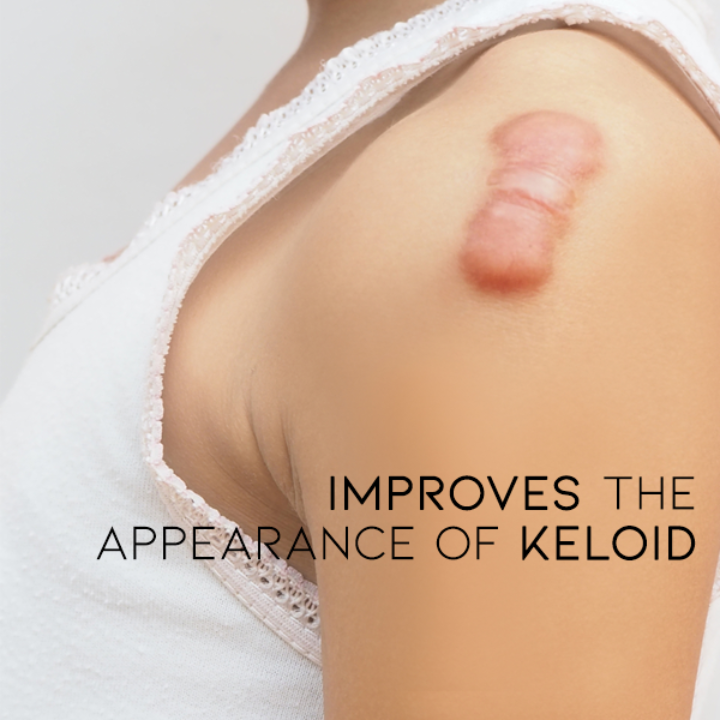 ⏰Limited Offer -Removing Scars, Scars And Lumps