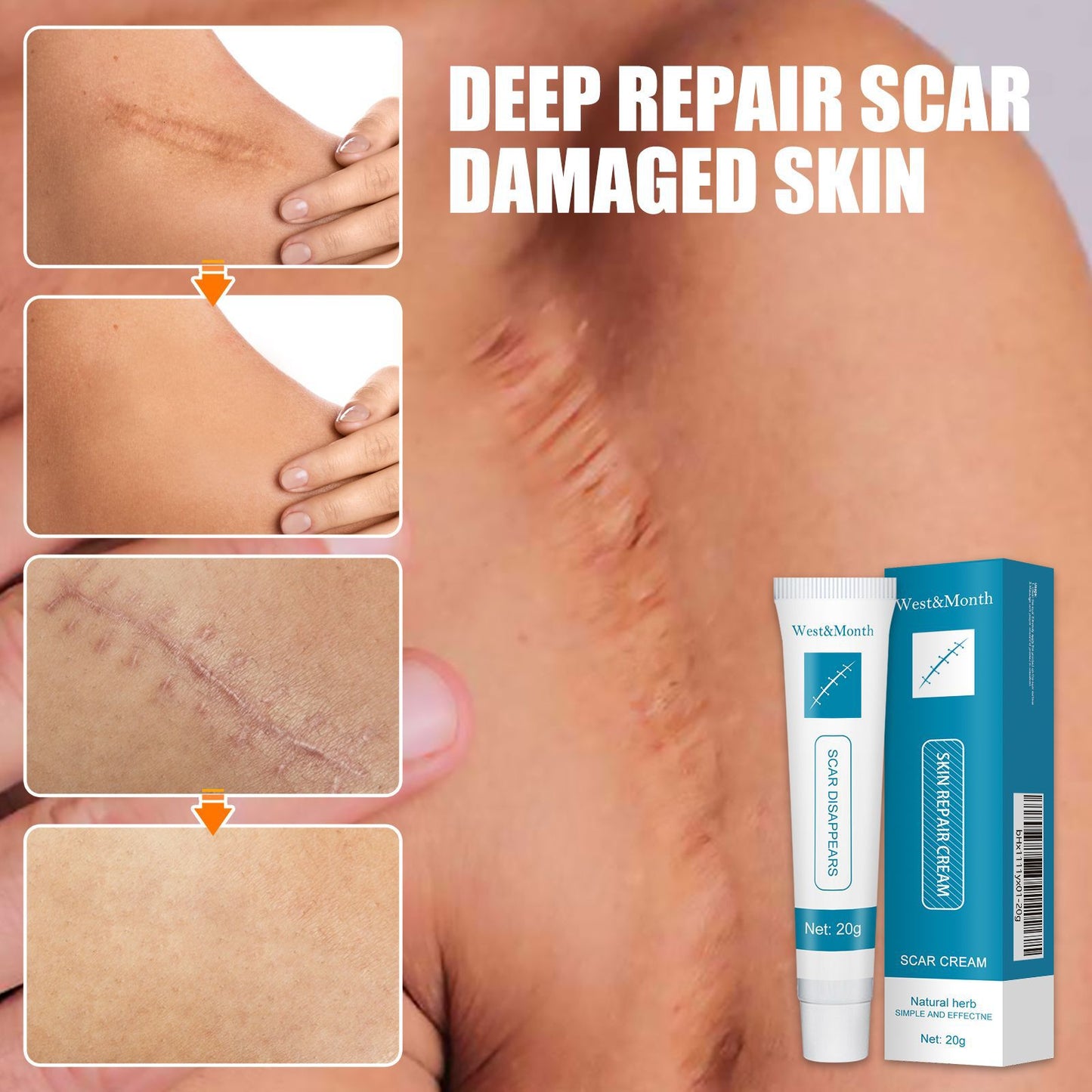 ⏰Limited Offer -Removing Scars, Scars And Lumps