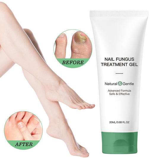 🔥Nail Fungus Treatment Gel