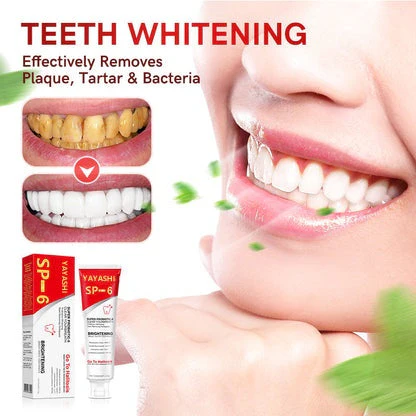 🎁2025 HOT SALE🎁 SP-6 Probiotic Whitening Toothpaste