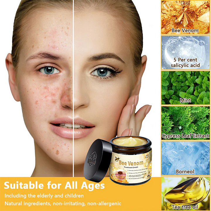 🎈Bee Venom Skin Treatment Cream（✅DERMATOLOGIST RECOMMENDED）