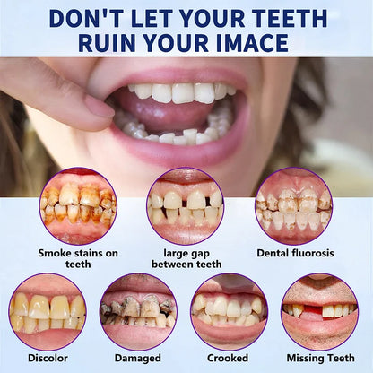 🎁Advanced Customized Full Denture Set🎁