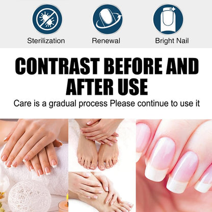 🎁Anti-Fungal Pen – Gets Rid Of Even the Most Stubborn Nail Fungus-51%off