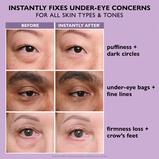 🎁Instant Eye Tightener Easy-Wear Formula-Ultimate Lift &Smooth Finish🎁