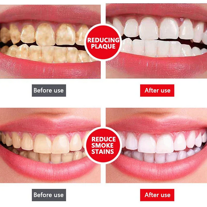 🎁2025 HOT SALE🎁 SP-6 Probiotic Whitening Toothpaste