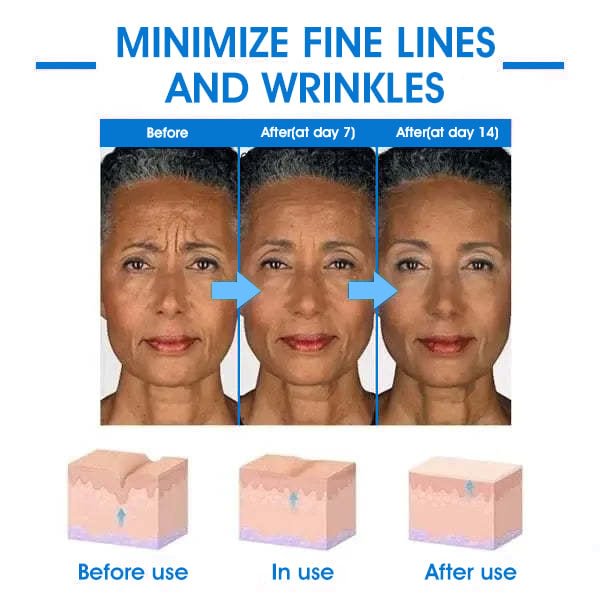 👑𝐅𝐢𝐧𝐚𝐥 𝐃𝐚𝐲 𝐒𝐚𝐯𝐢𝐧𝐠𝐬: 75% 𝐎𝐅𝐅🌐🍋👩‍⚕️ Ultra Firming & Revitalizing Cream: Renew Skin Firmness🔥