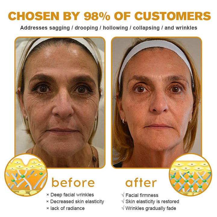 🎉LAST DAY 50% OFF🔥Reclaim youthful skin now! - 👩‍⚕️Botox Bee Venom Wrinkle Removal Cream